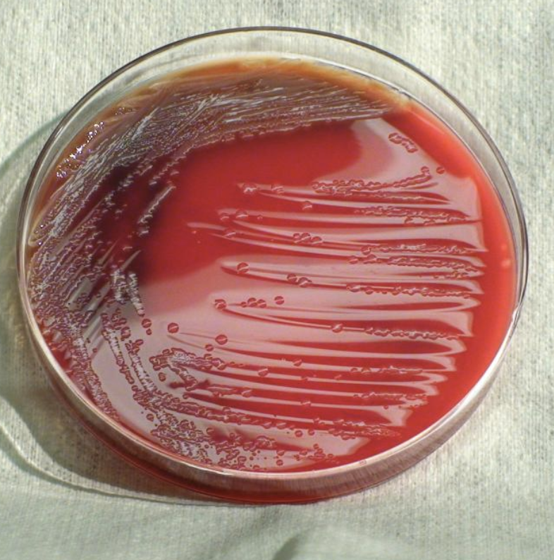 Shigellosis Cases Increase In Indian River County TreasureCoast 